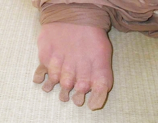 5toe pantyhose3